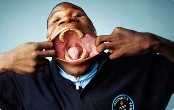 Как живёт мужчина с самым большим в мире ртом и почему ему больше нечего туда положить