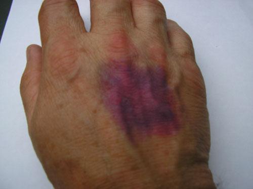 Странные и необъяснимые явления: появление стигматов и самовоспламенения Странные и необъяснимые явления: появление стигматов и самовоспламенения