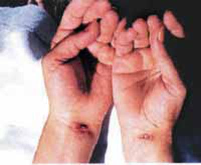 Странные и необъяснимые явления: появление стигматов и самовоспламенения Странные и необъяснимые явления: появление стигматов и самовоспламенения