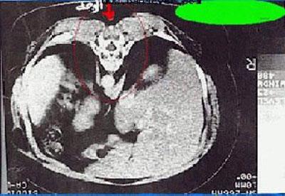 Странные и необъяснимые явления: появление стигматов и самовоспламенения Странные и необъяснимые явления: появление стигматов и самовоспламенения