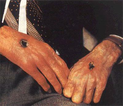 Странные и необъяснимые явления: появление стигматов и самовоспламенения Странные и необъяснимые явления: появление стигматов и самовоспламенения