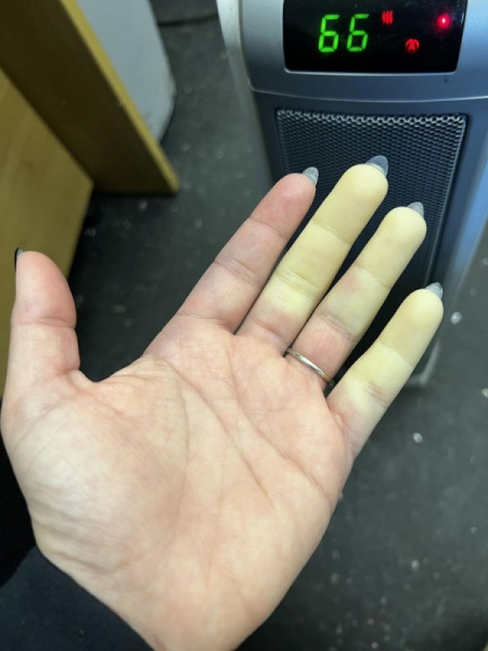 16 аномалий человеческого тела, которые делают их обладателей уникальными людьми 16 аномалий человеческого тела, которые делают их обладателей уникальными людьми