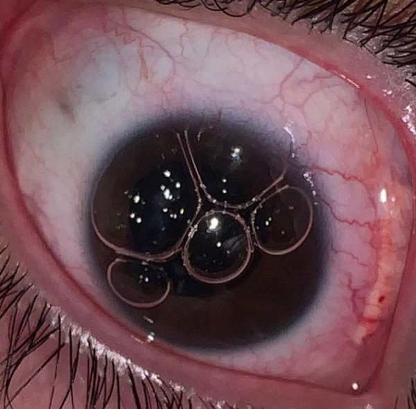 16 аномалий человеческого тела, которые делают их обладателей уникальными людьми 16 аномалий человеческого тела, которые делают их обладателей уникальными людьми