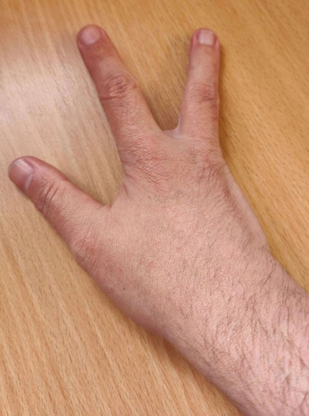 16 аномалий человеческого тела, которые делают их обладателей уникальными людьми 16 аномалий человеческого тела, которые делают их обладателей уникальными людьми