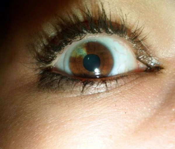 16 аномалий человеческого тела, которые делают их обладателей уникальными людьми 16 аномалий человеческого тела, которые делают их обладателей уникальными людьми