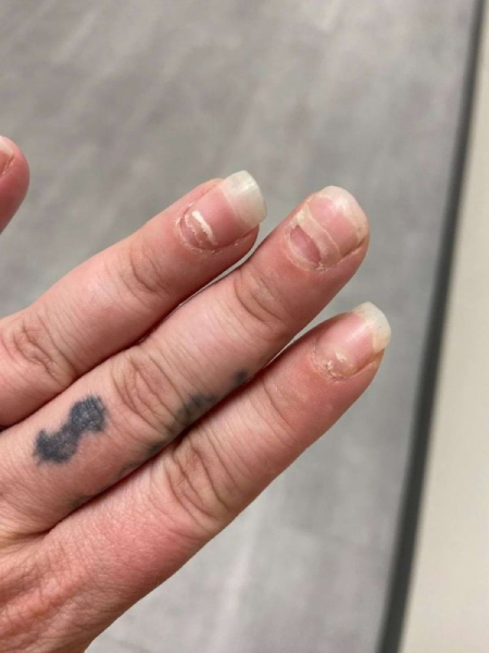 16 аномалий человеческого тела, которые делают их обладателей уникальными людьми 16 аномалий человеческого тела, которые делают их обладателей уникальными людьми